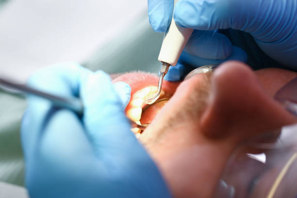 Best Emergency Dentist for Knocked-Out Tooth in Twin Lakes, CA